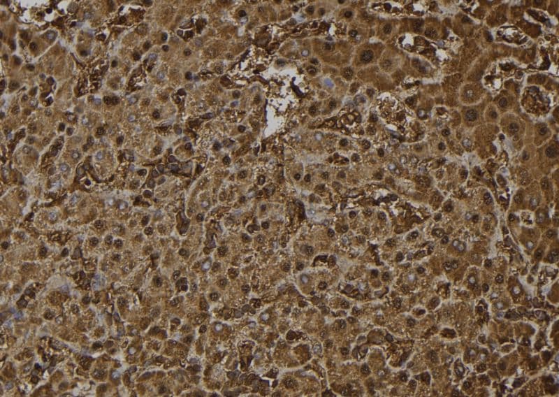 OTUB2 Antibody