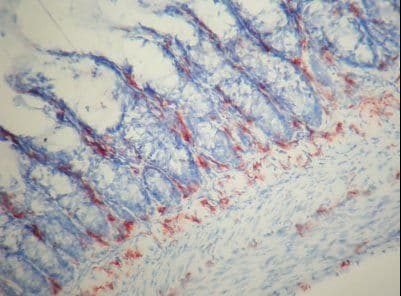 Macrophage Antibody (clone Ki-M2R)