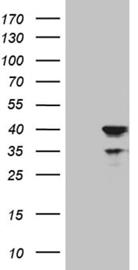 APOL1 / Apolipoprotein L Antibody (aa28-339, clone OTI5H4)