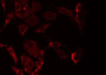 CHPF2 / CSGLCAT Antibody
