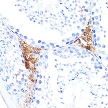 Polyclonal Rabbit anti-Human S100A10 Antibody (IHC, WB)