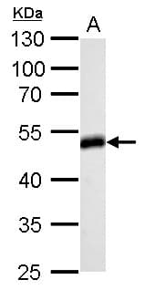 IHC-plus™ HOMER1 / Homer 1 Antibody (aa72-339)