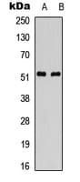 PARK2 / Parkin 2 Antibody (Internal)