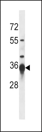 SIRT3 / Sirtuin 3 Antibody (aa250-279)