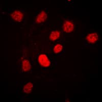 C/EBP Beta / CEBPB Antibody (phospho-Thr235)