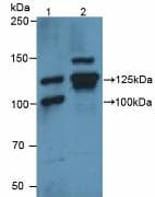VCL / Vinculin Antibody (aa1020-1134)