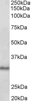 IHC-plus™ CTDSP1 / SCP1 Antibody (aa82-92)