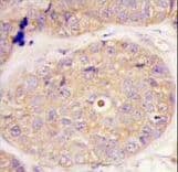 GGPS1 Antibody (aa270-300)
