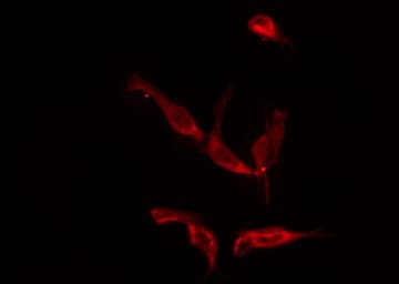 CYSLTR1 / CYSLT1 Antibody