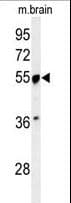 Polyclonal Rabbit anti-Human PRPF19 / PRP19 Antibody (aa4-33, IHC, WB)