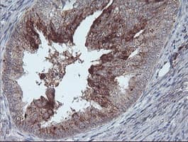 RLBP1 / CRALBP Antibody (clone OTI1G6)