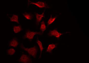 CHUK / IKKA / IKK Alpha Antibody