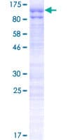 Human HMG2L1 / HMGXB4 Protein (Recombinant GST)