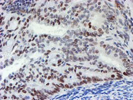 MLF1 Antibody (clone OTI5D9)