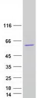 Human TS / Thromboxane Synthase Protein (Recombinant Myc-DDK (Flag))