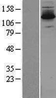 DZIP3 Protein (Over-Expression Lysate Myc-DDK (Flag))