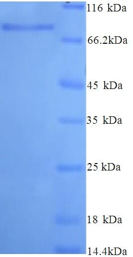 Human NAALADL2 Protein (Recombinant His)