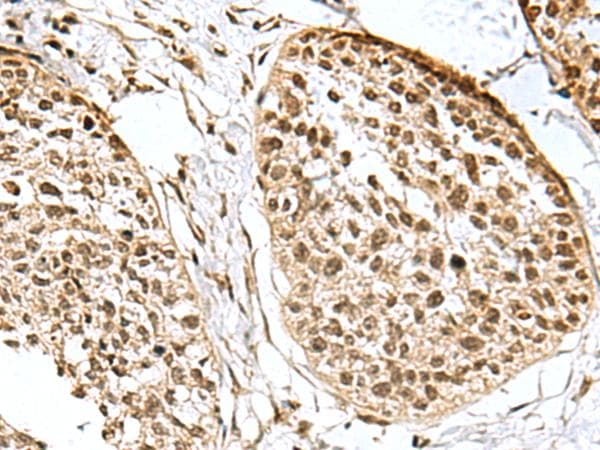 H2AFJ Antibody