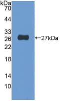 NUP155 Antibody (aa1154-1379)