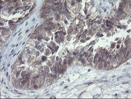 CHN1 Antibody (clone OTI2D10, Carrier-free)