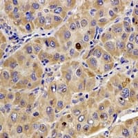 TMOD4 Antibody