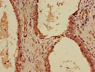 QIP1 / KPNA4 Antibody