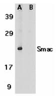 Polyclonal Rabbit anti-Human DIABLO / SMAC Antibody (IHC, WB)