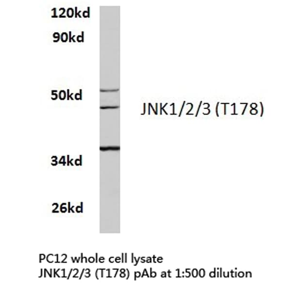 JNK1+2+3 Antibody (Thr178)