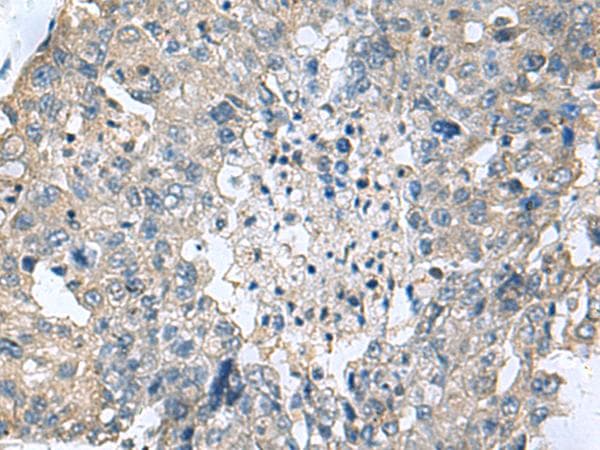 TGM3 / Transglutaminase 3 Antibody