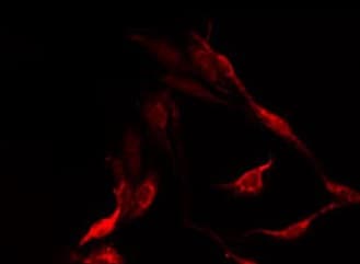 Polyclonal Rabbit anti-Human OR10X1 Antibody (IF, WB)