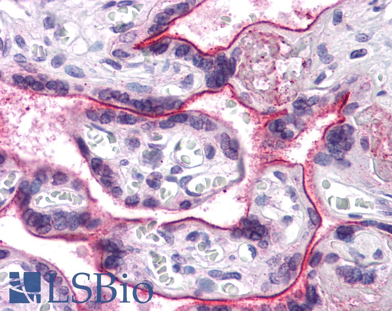 IHC-plus™ Polyclonal Rabbit anti-Human APC6 / CDC16 Antibody (IHC, IF, WB)