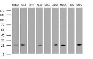 CMPK / CMPK1 Antibody (clone OTI1H3)
