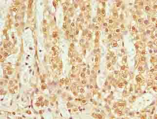 TMEM205 Antibody