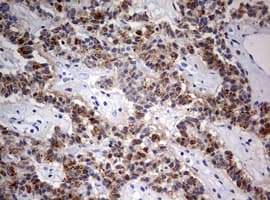 FEN1 Antibody (aa117-380, clone OTI1F3)