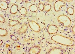 Polyclonal Rabbit anti-Human CHMP1B Antibody (aa1-199, IHC)