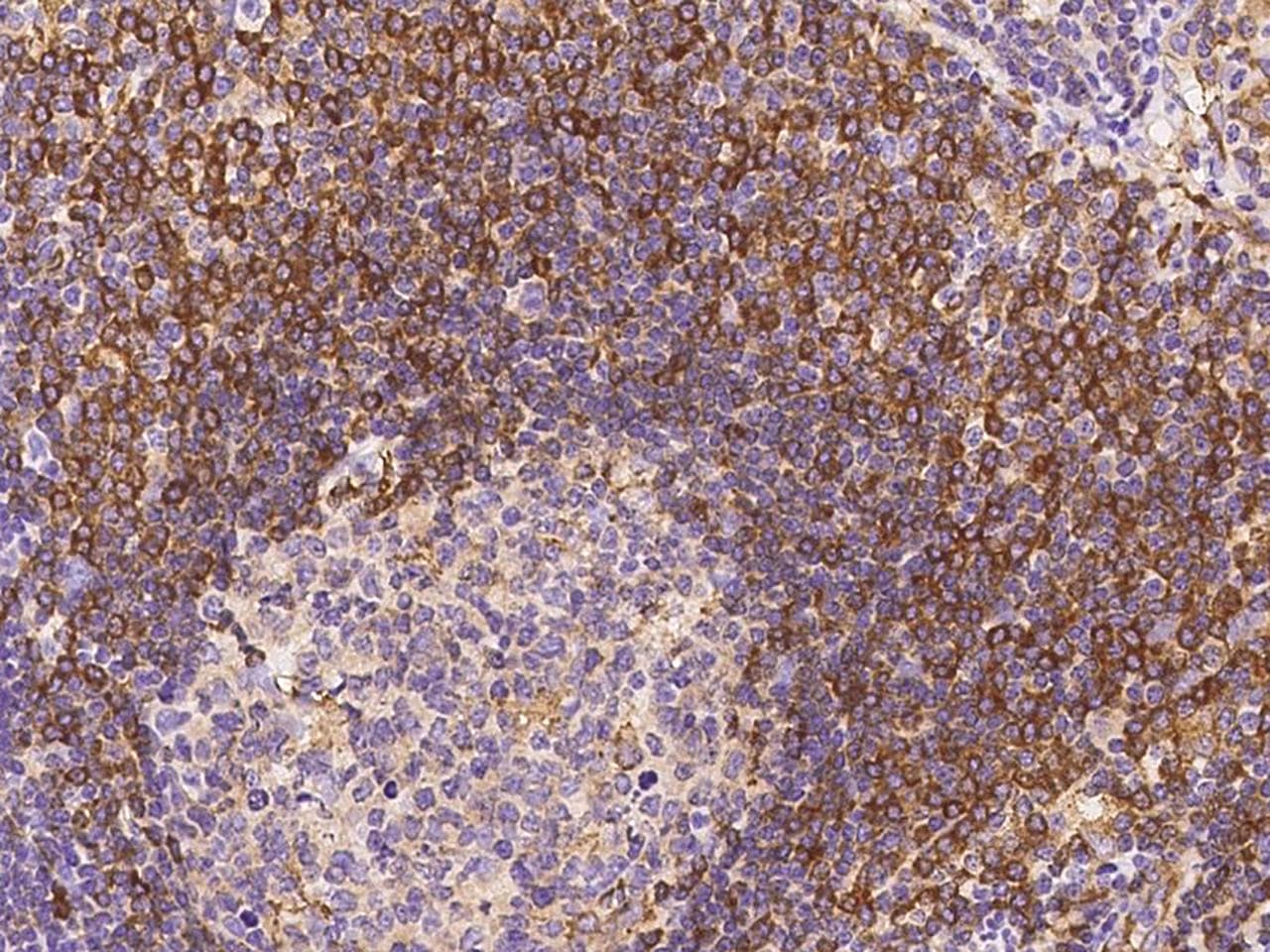 ABI3 Antibody