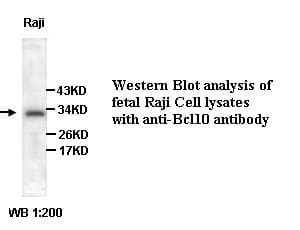 IHC-plus™ BCL10 / BCL-10 Antibody (C-Terminus)