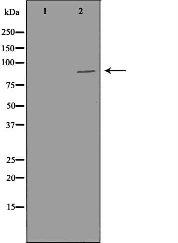 PIBF1 / PIBF Antibody