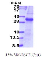Human TMPRSS15 / Enterokinase Protein (Recombinant)