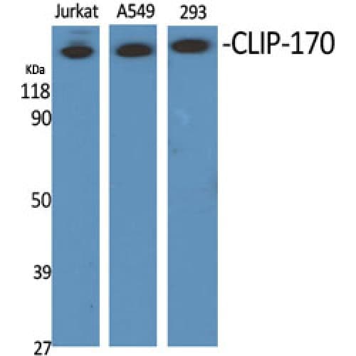 Polyclonal Rabbit anti-Human CLIP1 / CLIP-170 Antibody (1260-1340 aa, C-terminal, WB)