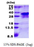 Human CHMP1A Protein (Recombinant His)