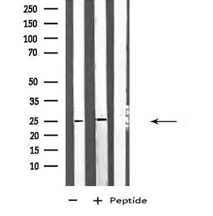 ARHGDIG / RHOGDI-3 Antibody