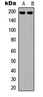 Polyclonal Rabbit anti-Human PEAK1 / SGK269 Antibody (N-Terminus, WB)