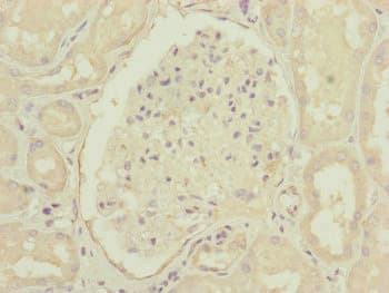 CEP83 / CCDC41 Antibody