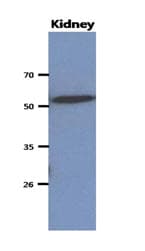 IHC-plus™ Monoclonal Mouse anti-Human CNDP2 Antibody (clone AT15E5, IHC, WB)