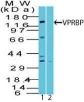 VPRBP Antibody (aa935-985)