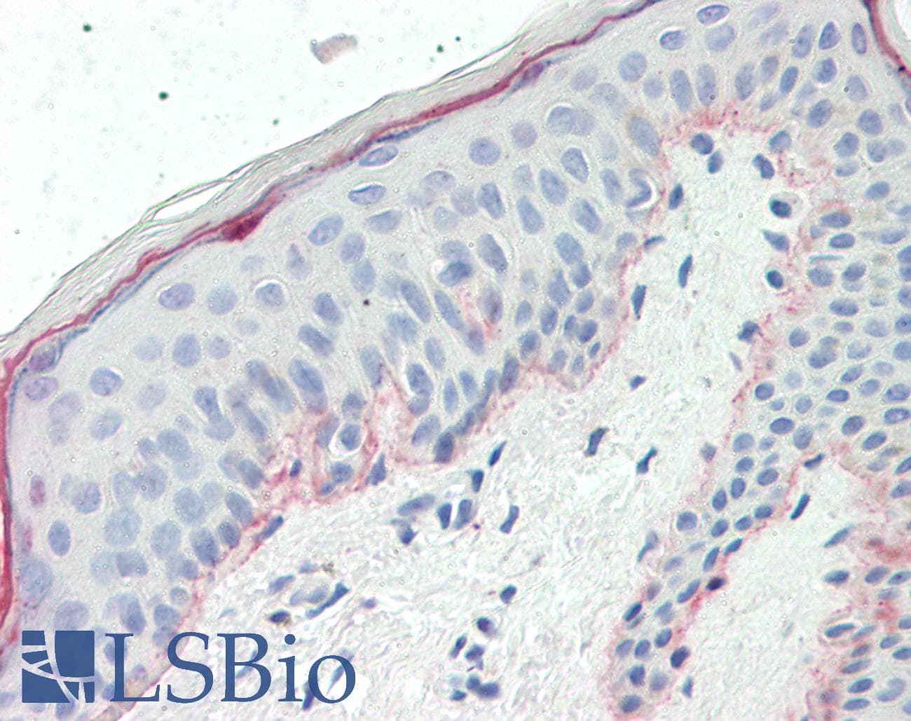 IHC-plus™ COL7A1 / Collagen VII Antibody (aa1841-1890)