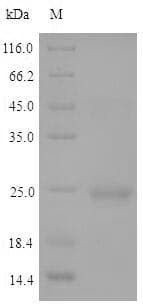 Arabidopsis thaliana HDT2 Protein (Recombinant 6His, N-terminus)