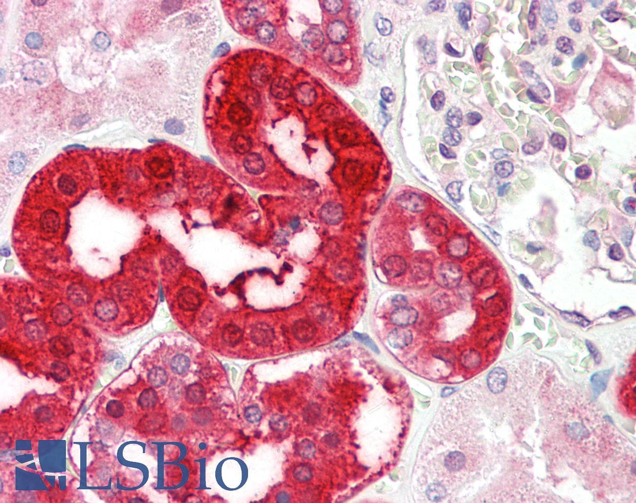 IHC-plus™ LNPEP Antibody