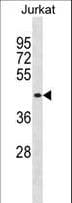 Polyclonal Rabbit anti-Human MBNL1 / MBNL Antibody (aa255-284, WB)